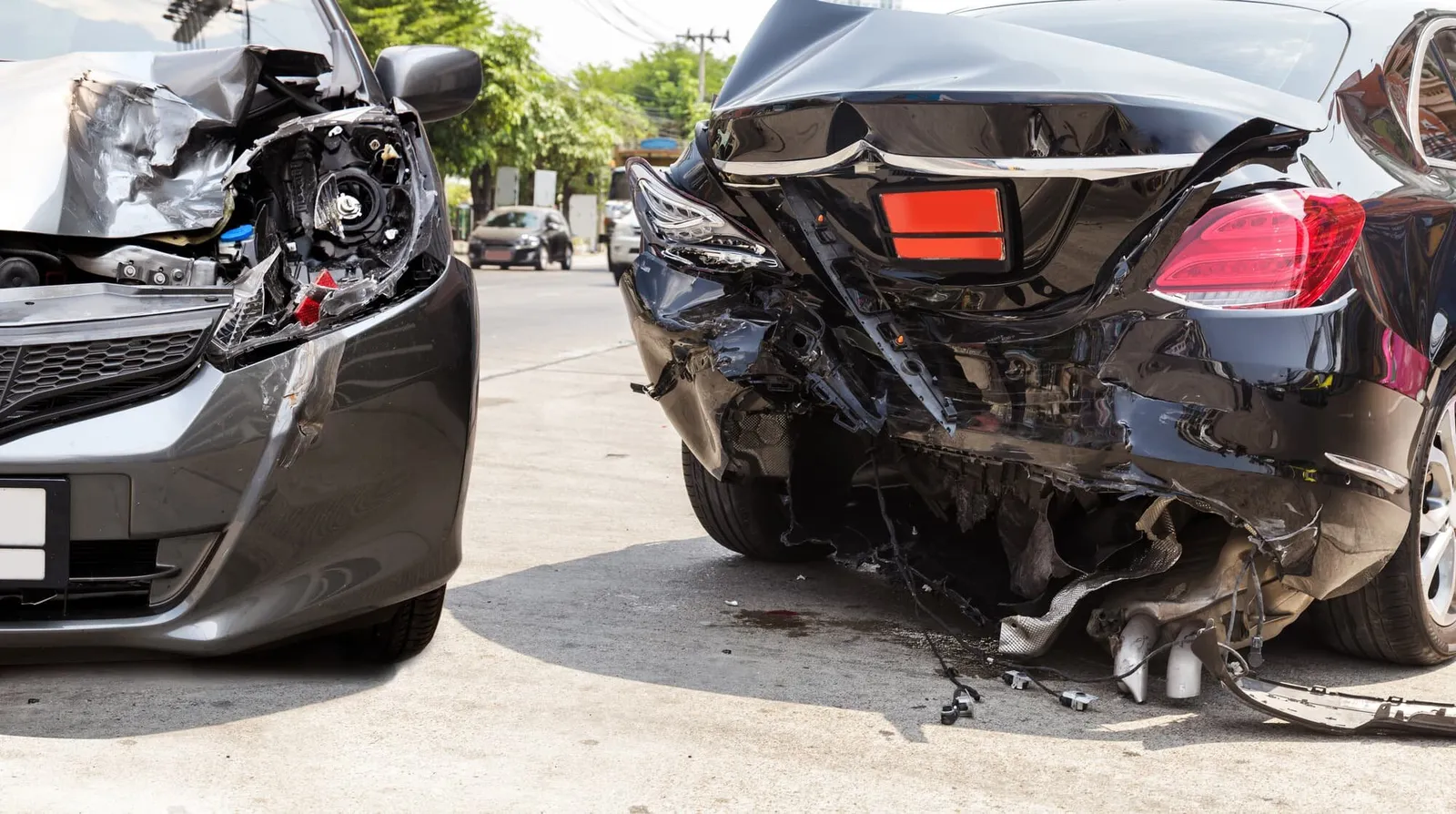 Why You Should See a Chiropractor After an Auto Accident